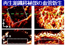 光音響イメージング技法を用いた培養組織移植後経過の非侵襲観察